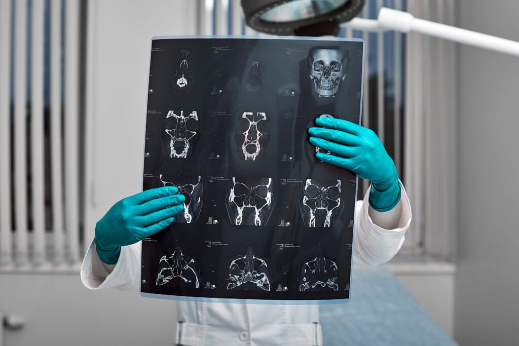 Image of a digital scan or X-ray being reviewed by AI software, symbolizing innovation in healthcare.