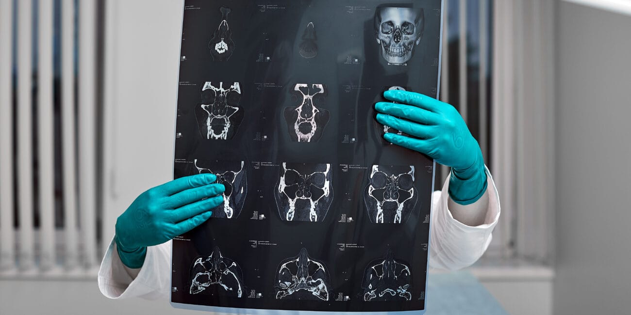 Doctor attentively examines the MRI scan of the patient